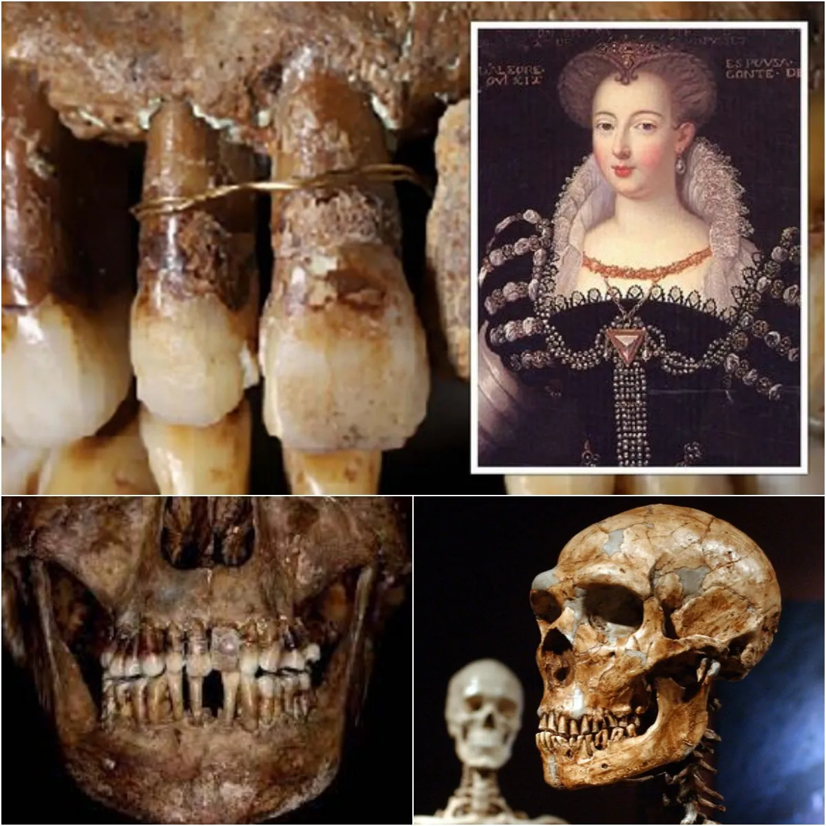 Estos son los arqueólogos que descubrieron los dientes de una mujer francesa del siglo XVII cubiertos de oro sólido, despertando la curiosidad de todos.